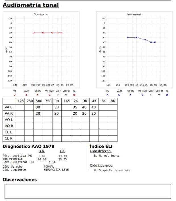 interpretación audiometría audiograma