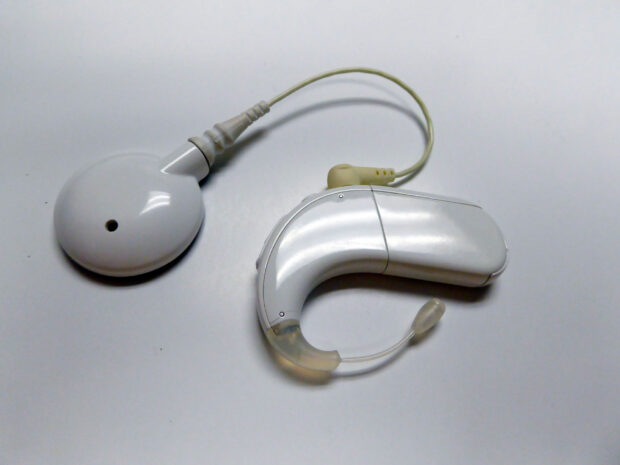 implantes cocleares audífonos sordos